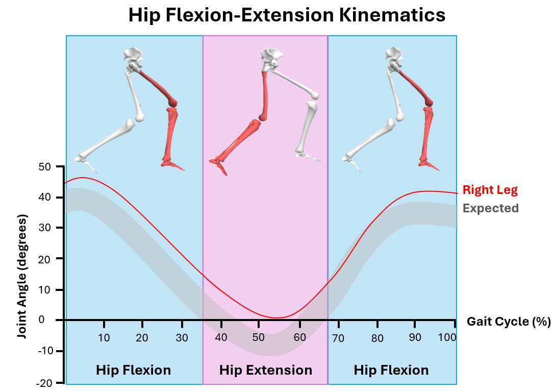 Example of a kinematics plot for the hip in reference to one gait cycle