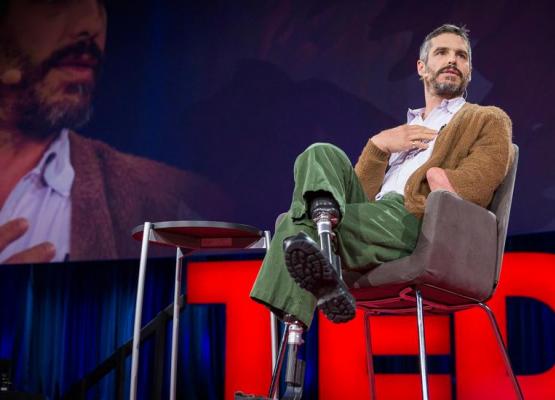 Man with amputations on stage doing Ted Talk