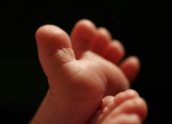 Is newborn euthanasia an answer to parent pain?