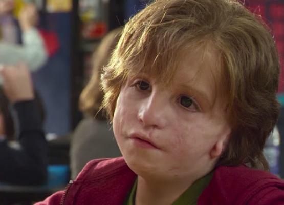 A mask doesn't belong in a film about courage to be who you are