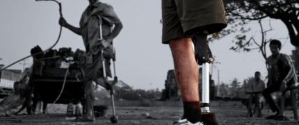 prosthetic leg solution in a developing country