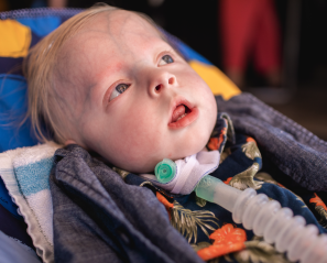 Young boy with tracheostomy tube lying in a chair facing upwards