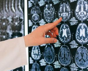 Image of brain scans being reviewed by health-care team member. Credit: Pexels.com Anna Shvets