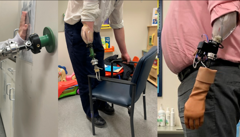 Examples of the adjustable diagnostic forearm in action.