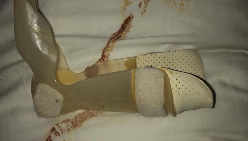 Dennisse's first AFO, or leg brace, spread out on a duvet