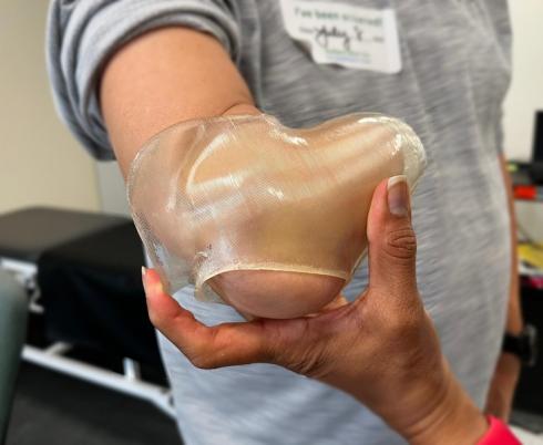 Client trying out a part of a prosthetic that has been 3D-printed